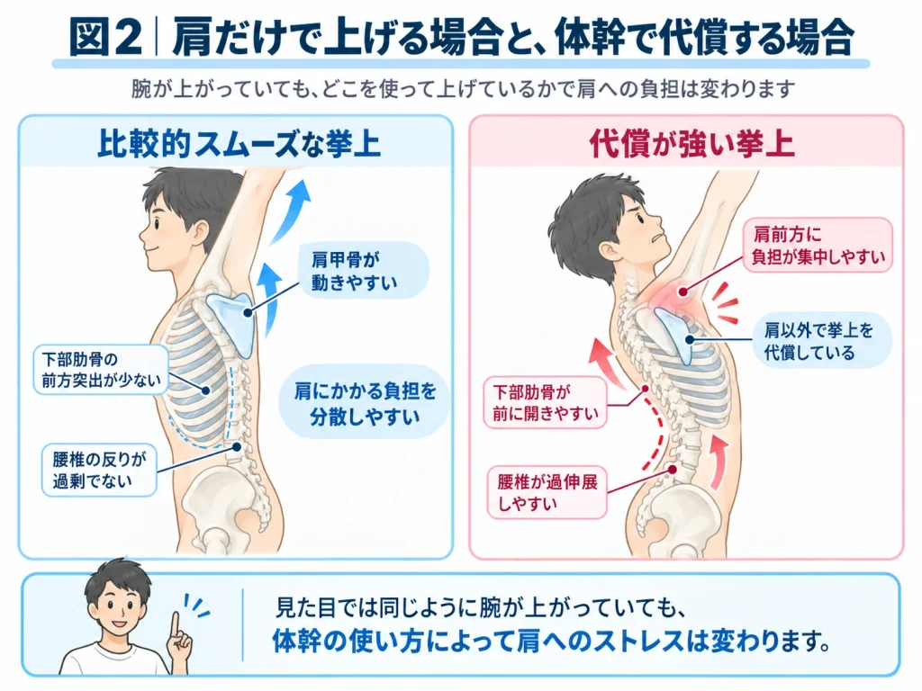 腕を上げる際の肩甲骨の動きと、下部肋骨の前方突出・腰椎過伸展による代償動作を比較した図